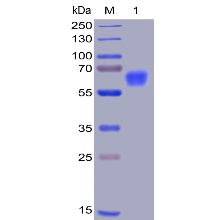 SDS-PAGE - Recombinant Human CD47 Protein (Fc Chimera 6xHis Tag) (A318400) - Antibodies.com