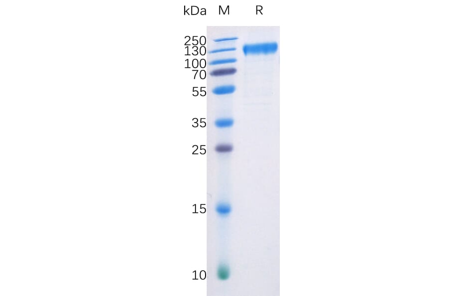 SDS-PAGE - Recombinant Human Flt3/CD135 Protein (Fc Chimera 6xHis Tag) (A318401) - Antibodies.com