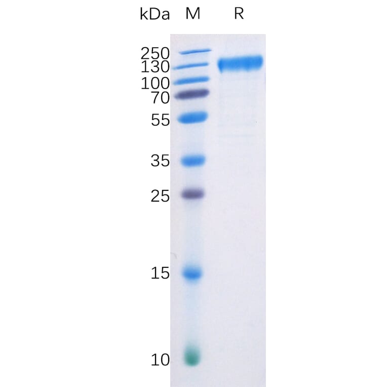 SDS-PAGE - Recombinant Human Flt3/CD135 Protein (Fc Chimera 6xHis Tag) (A318401) - Antibodies.com