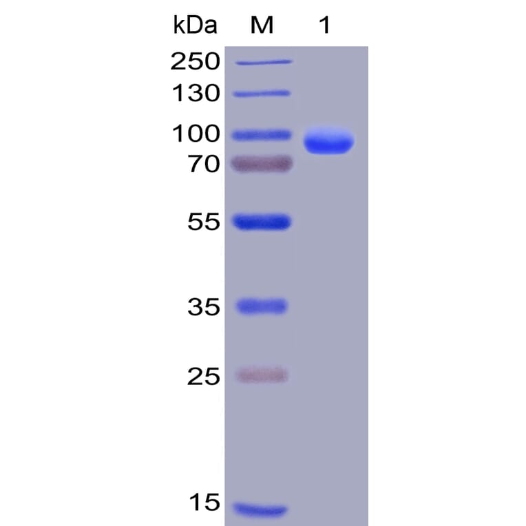 SDS-PAGE - Recombinant Human Syndecan-1 Protein (Fc Chimera 6xHis Tag) (A318402) - Antibodies.com