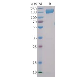 SDS-PAGE - Recombinant Human CD22 Protein (Fc Chimera 6xHis Tag) (A318403) - Antibodies.com