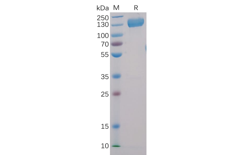 SDS-PAGE - Recombinant Human CD22 Protein (Fc Chimera 6xHis Tag) (A318403) - Antibodies.com