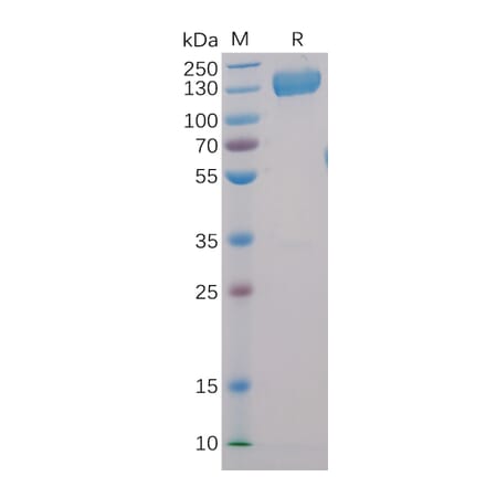 SDS-PAGE - Recombinant Human CD22 Protein (Fc Chimera 6xHis Tag) (A318403) - Antibodies.com