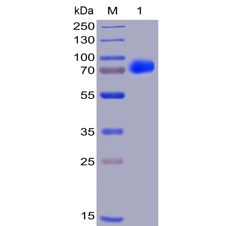SDS-PAGE - Recombinant Human SLAMF7/CS1 Protein (Fc Chimera 6xHis Tag) (A318406) - Antibodies.com