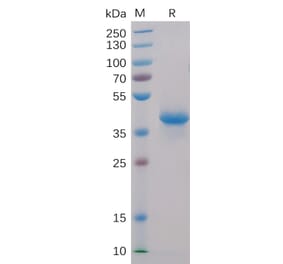 SDS-PAGE - Recombinant Human BCMA Protein (Fc Chimera 6xHis Tag) (A318407) - Antibodies.com