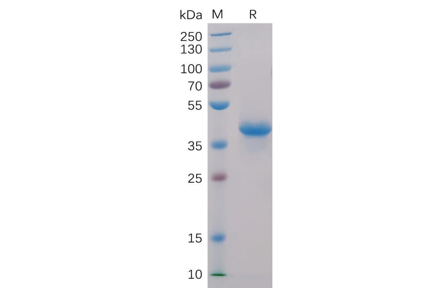 SDS-PAGE - Recombinant Human BCMA Protein (Fc Chimera 6xHis Tag) (A318407) - Antibodies.com