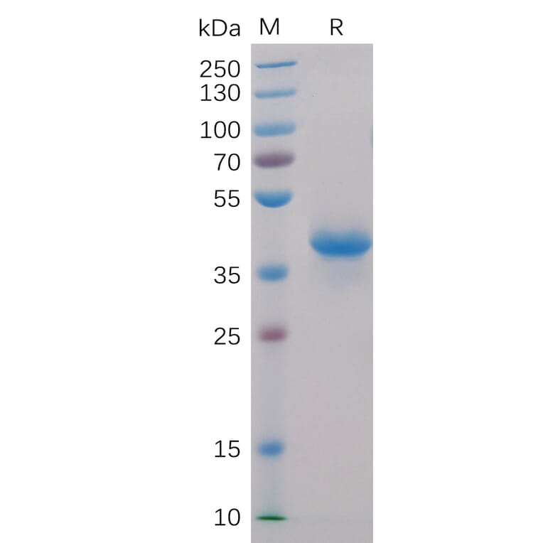SDS-PAGE - Recombinant Human BCMA Protein (Fc Chimera 6xHis Tag) (A318407) - Antibodies.com