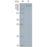 SDS-PAGE - Synthetic Nanodisc Human TLR7 Protein (A318412) - Antibodies.com