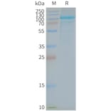 SDS-PAGE - Synthetic Nanodisc Human TLR5 Protein (A318413) - Antibodies.com