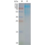 SDS-PAGE - Synthetic Nanodisc Human CD37 Protein (A318458) - Antibodies.com