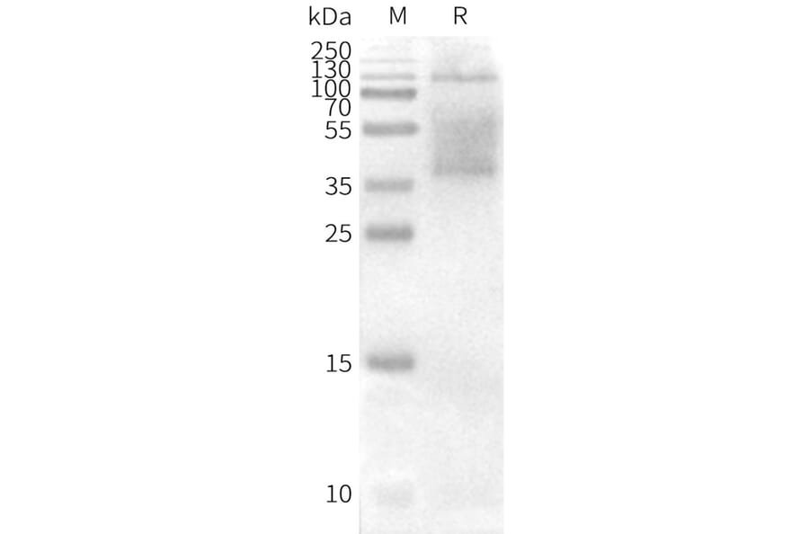 Western Blot - Synthetic Nanodisc Human CD37 Protein (A318458) - Antibodies.com