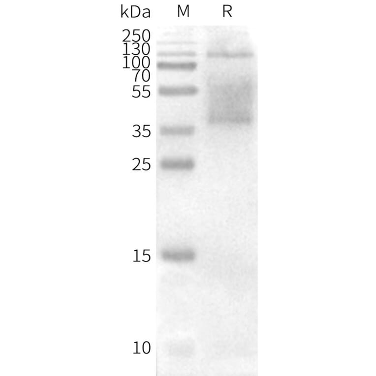 Western Blot - Synthetic Nanodisc Human CD37 Protein (A318458) - Antibodies.com