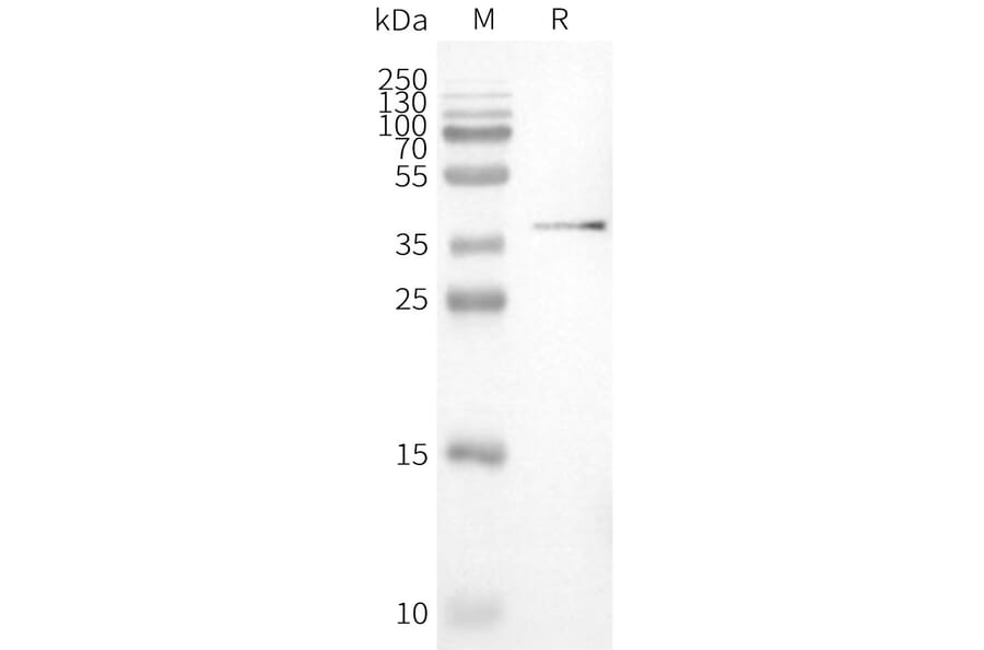 Western Blot - Synthetic Nanodisc Human PVRIG/CD112R Protein (A318459) - Antibodies.com