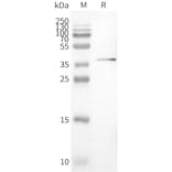 Western Blot - Synthetic Nanodisc Human PVRIG/CD112R Protein (A318459) - Antibodies.com