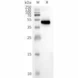 Western Blot - Synthetic Nanodisc Human CCR8 Protein (A318461) - Antibodies.com