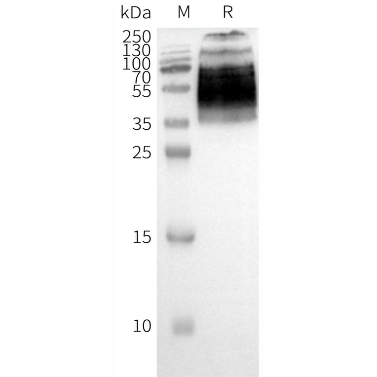 Western Blot - Synthetic Nanodisc Human PAR2 Protein (A318462) - Antibodies.com