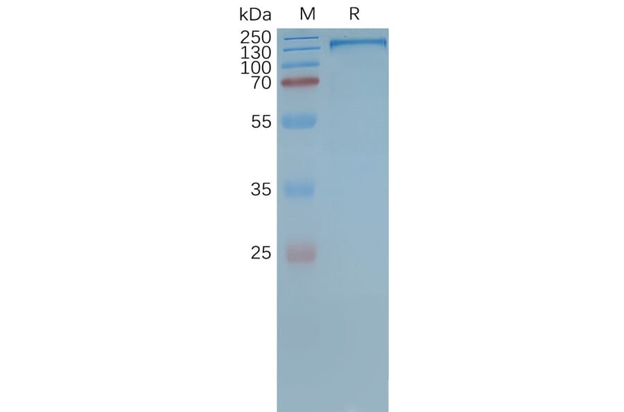 SDS-PAGE - Synthetic Nanodisc Human P Glycoprotein Protein (A318469) - Antibodies.com