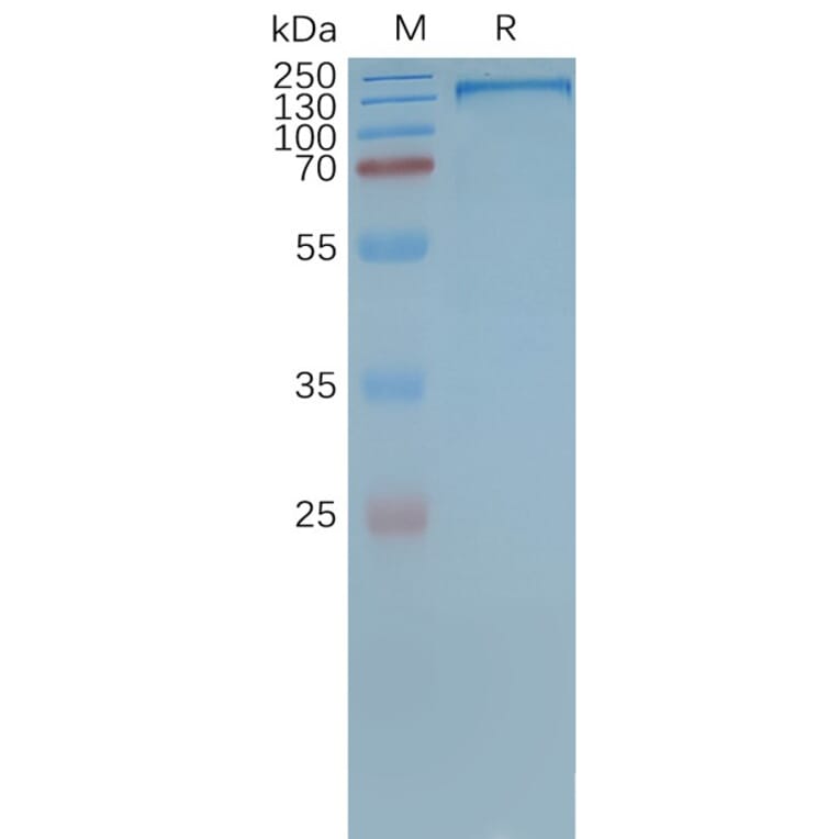 SDS-PAGE - Synthetic Nanodisc Human P Glycoprotein Protein (A318469) - Antibodies.com