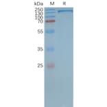 SDS-PAGE - Synthetic Nanodisc Human P Glycoprotein Protein (A318469) - Antibodies.com