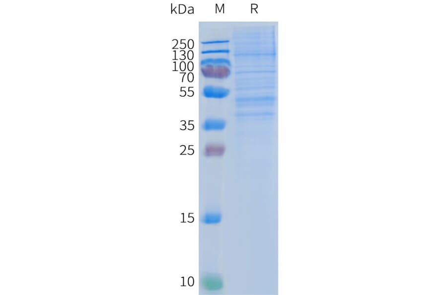SDS-PAGE - Synthetic Nanodisc Human CCR2 Protein (A318470) - Antibodies.com