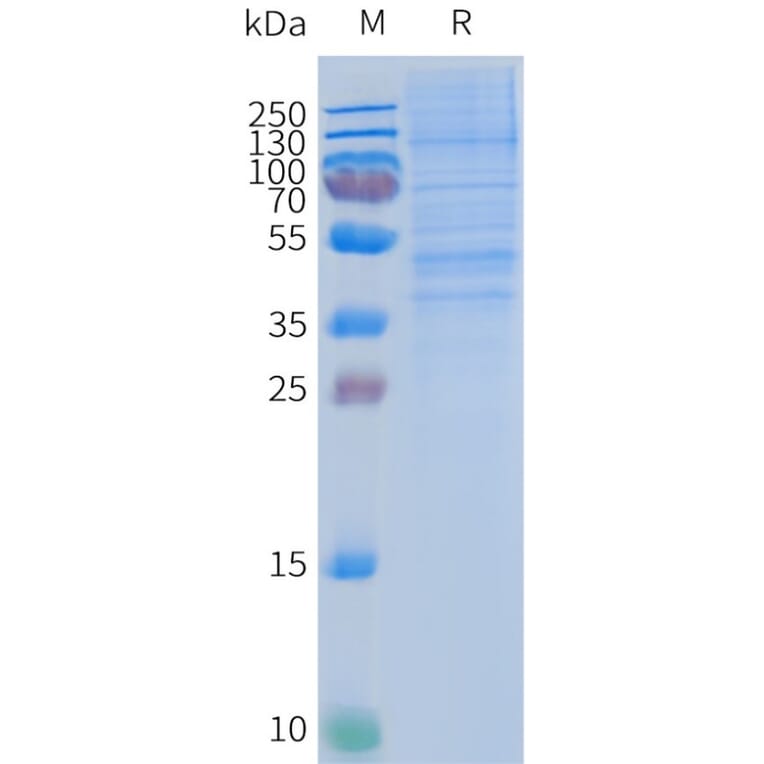 SDS-PAGE - Synthetic Nanodisc Human CCR2 Protein (A318470) - Antibodies.com