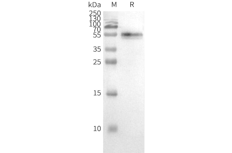 Western Blot - Synthetic Nanodisc Human CCR2 Protein (A318470) - Antibodies.com