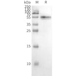 Western Blot - Synthetic Nanodisc Human CCR2 Protein (A318470) - Antibodies.com