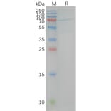 SDS-PAGE - Synthetic Nanodisc Human Cannabinoid Receptor I Protein (A318475) - Antibodies.com
