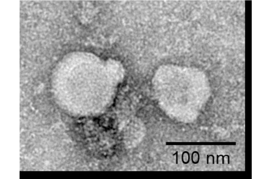 TEM - Synthetic Exosome Human GPCR GPRC5D Protein (A318487) - Antibodies.com