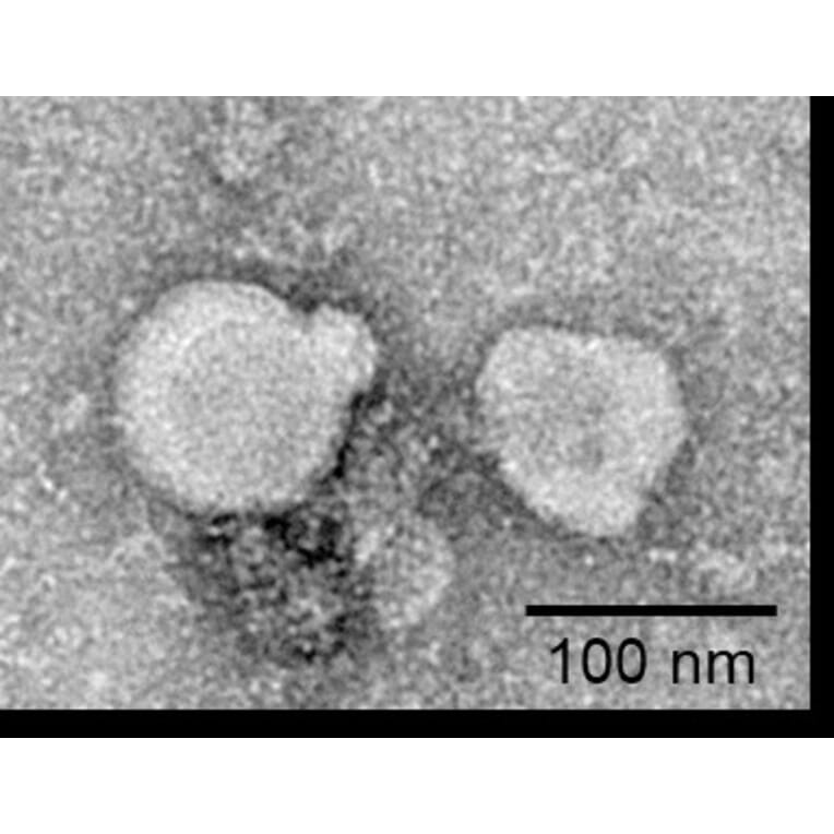 Recombinant Exosome Human GPCR GPRC5D Protein (A318487) - Antibodies.com