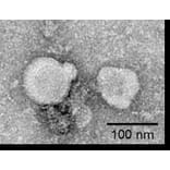 TEM - Synthetic Exosome Human GPCR GPRC5D Protein (A318487) - Antibodies.com