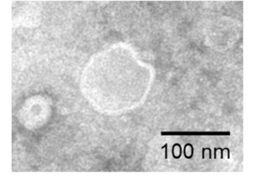 TEM - Synthetic Exosome Human CD24 Protein (A318492) - Antibodies.com