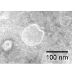 TEM - Synthetic Exosome Human CD24 Protein (A318492) - Antibodies.com