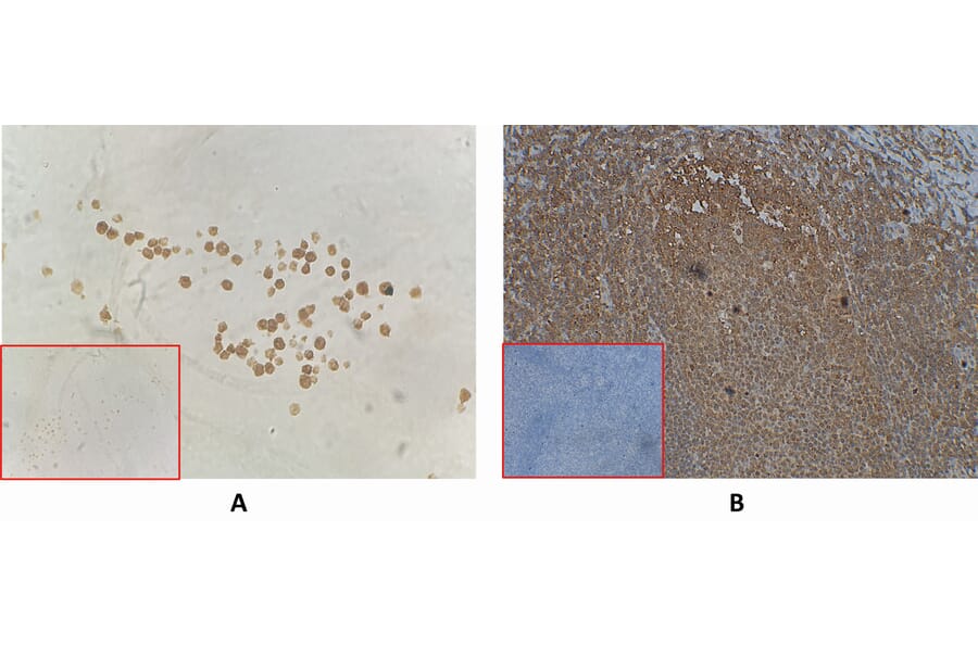Immunohistochemistry - Anti-BAFF-R Antibody [DM143] - BSA and Azide free (A318565) - Antibodies.com