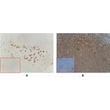 Immunohistochemistry - Anti-BAFF-R Antibody [DM143] - BSA and Azide free (A318565) - Antibodies.com