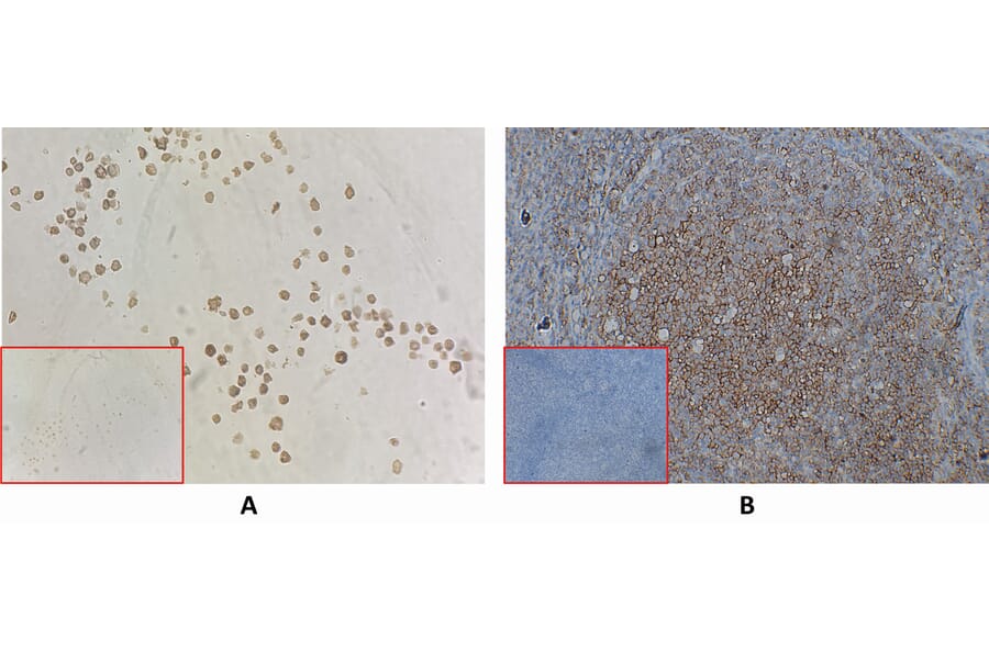 Immunohistochemistry - Anti-CD40 Antibody [DM100] - BSA and Azide free (A318605) - Antibodies.com
