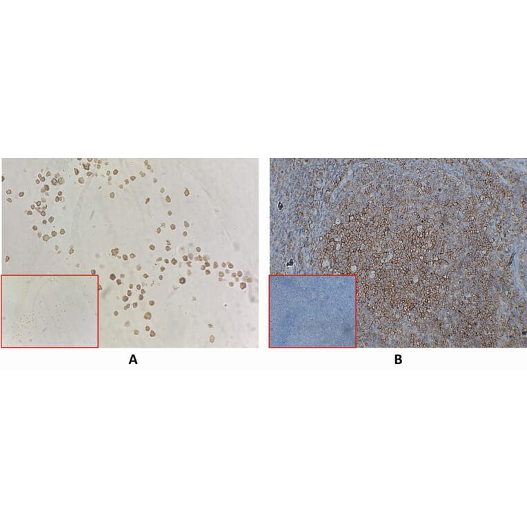 Immunohistochemistry - Anti-CD40 Antibody [DM100] - BSA and Azide free (A318605) - Antibodies.com