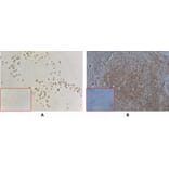 Immunohistochemistry - Anti-CD40 Antibody [DM100] - BSA and Azide free (A318605) - Antibodies.com