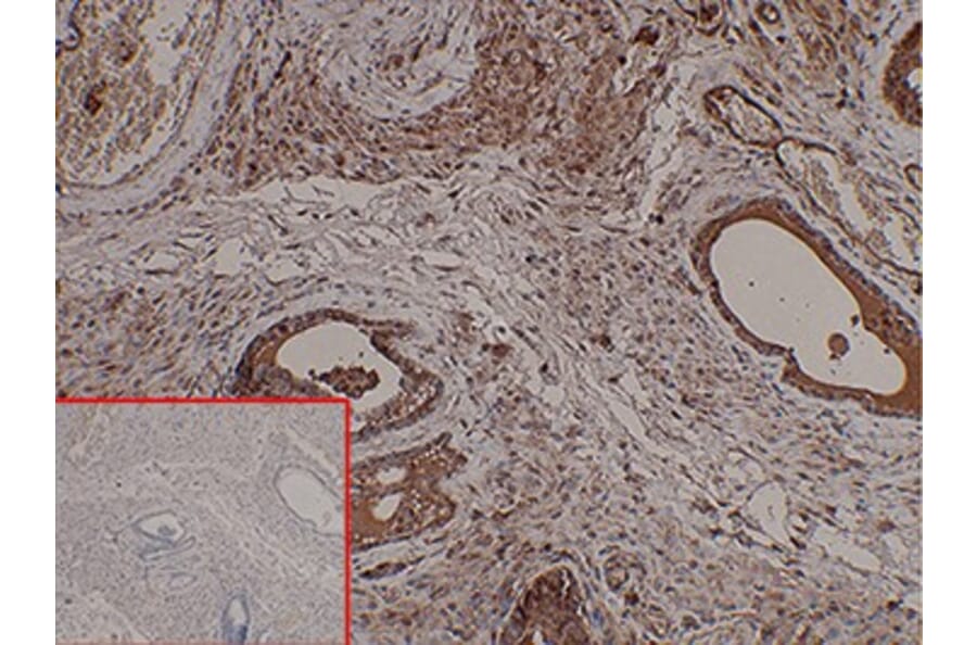 Immunohistochemistry - Anti-PSCA Antibody [DM87] - BSA and Azide free (A318620) - Antibodies.com