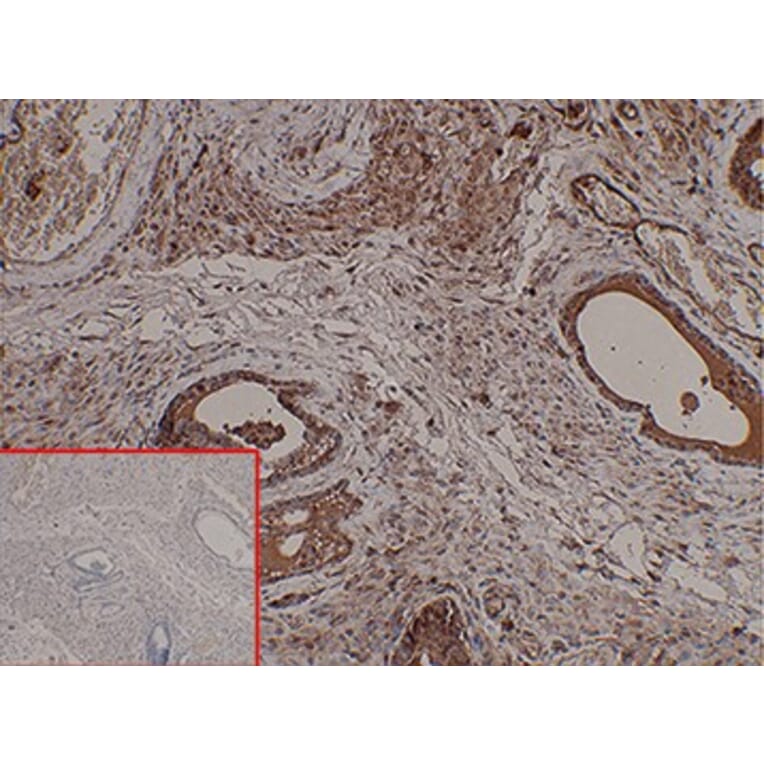 Immunohistochemistry - Anti-PSCA Antibody [DM87] - BSA and Azide free (A318620) - Antibodies.com