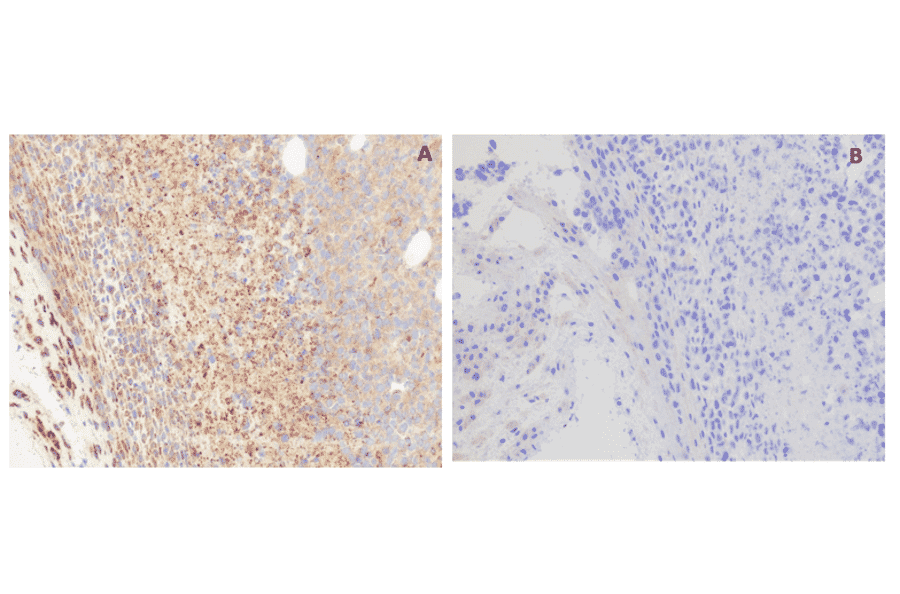 Immunohistochemistry - Anti-GPCR GPRC5D Antibody [DM61] - BSA and Azide free (A318636) - Antibodies.com