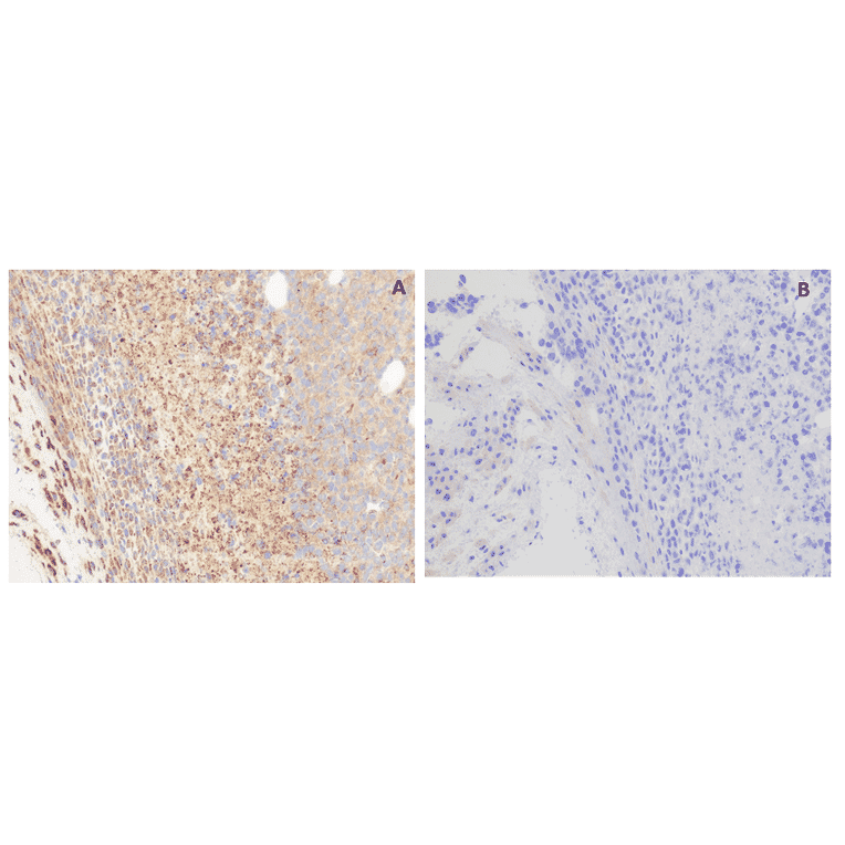 Immunohistochemistry - Anti-GPCR GPRC5D Antibody [DM61] - BSA and Azide free (A318636) - Antibodies.com