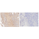 Immunohistochemistry - Anti-GPCR GPRC5D Antibody [DM61] - BSA and Azide free (A318636) - Antibodies.com