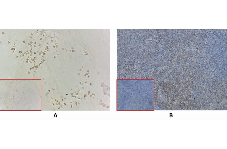 Immunohistochemistry - Anti-CD27 Antibody [DM59] - BSA and Azide free (A318638) - Antibodies.com