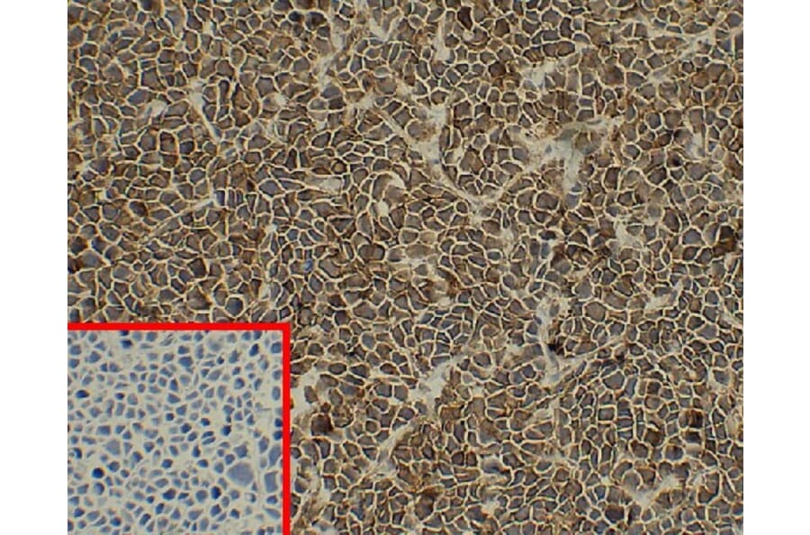 Immunohistochemistry - Anti-Syndecan-1 Antibody [DM45] - BSA and Azide free (A318650) - Antibodies.com