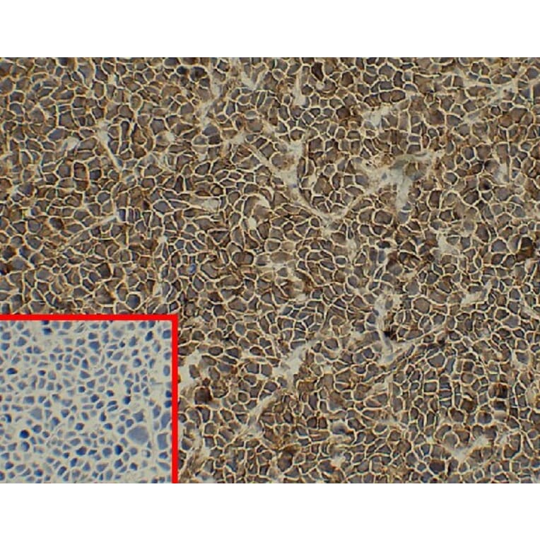 Immunohistochemistry - Anti-Syndecan-1 Antibody [DM45] - BSA and Azide free (A318650) - Antibodies.com
