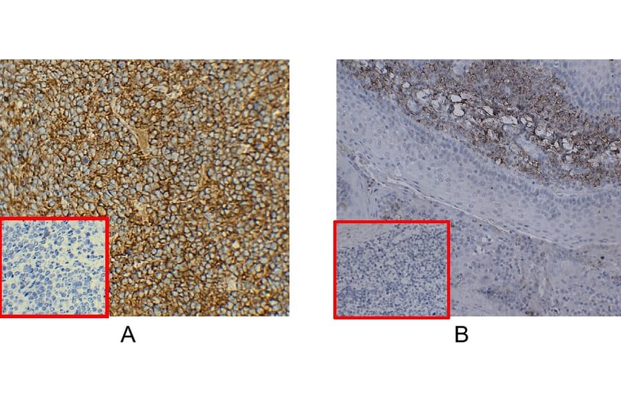 Immunohistochemistry - Anti-CD38 Antibody [DM28] - BSA and Azide free (A318665) - Antibodies.com