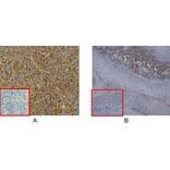Immunohistochemistry - Anti-CD38 Antibody [DM28] - BSA and Azide free (A318665) - Antibodies.com