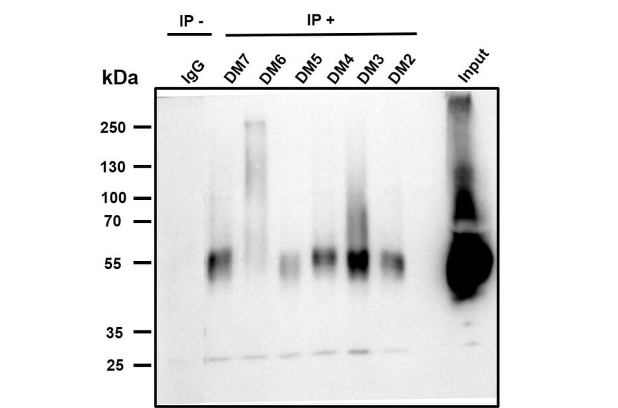 Immunoprecipitation - Anti-BCMA Antibody [DM6] - BSA and Azide free (A318678) - Antibodies.com