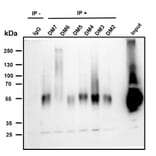 Immunoprecipitation - Anti-BCMA Antibody [DM6] - BSA and Azide free (A318678) - Antibodies.com